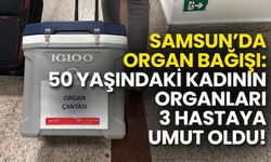 Samsun’da Organ Bağışı: 50 Yaşındaki Kadının Organları 3 Hastaya Umut Oldu!