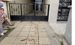 Boşanma aşamasındaki eşini boğazından bıçaklayarak ağır yaraladı