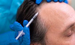 Kelliğe Çözüm mü? Yeni İlaç Saçları %539 Artırdı