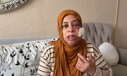 Elektrikli bisikleti ile kapağı kırık rögara düştü; yüzüne 14 dikiş atıldı