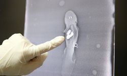 Akvaryumda taş yutan aksolotl balığı ameliyat edildi