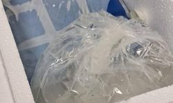 Köpek saldırısına parmağı koptu; o anlar kamerada