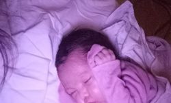 Sindirim, idrar ve üreme çıkışı tek olan Kırgız bebek, İstanbul'da sağlığına kavuştu