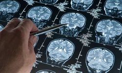 Araştırma: Derin Uyku Alzheimer'ı Yavaşlatıyor