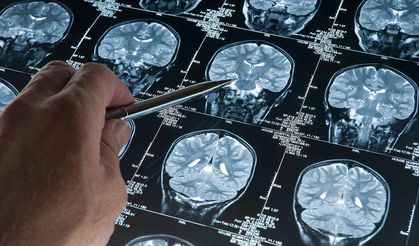 Araştırma: Derin Uyku Alzheimer'ı Yavaşlatıyor