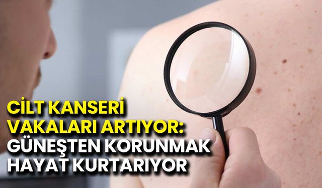 Cilt Kanseri Vakaları Artıyor: Güneşten Korunmak Hayat Kurtarıyor