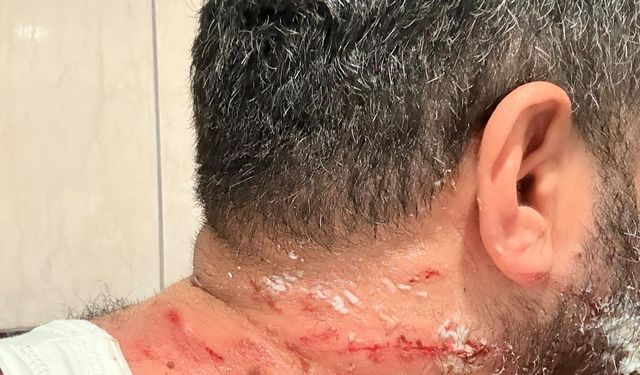 Tamir sırasında TIR'ın sağlam lastiği patladı; 1 yaralı