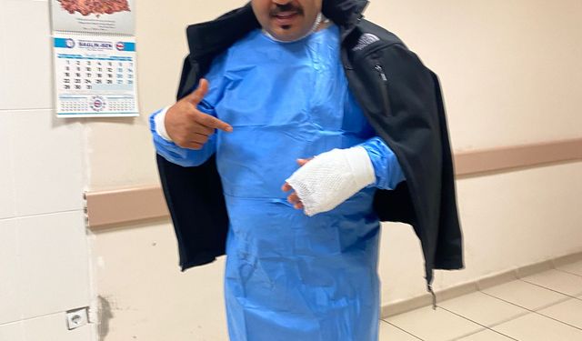 Soğuk havayı test etmek isterken kendini yaktı