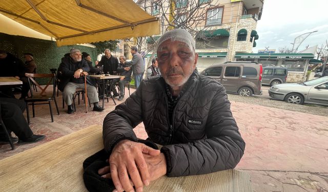 Önce çakmak istediler ardından sokak ortasında darbettiler