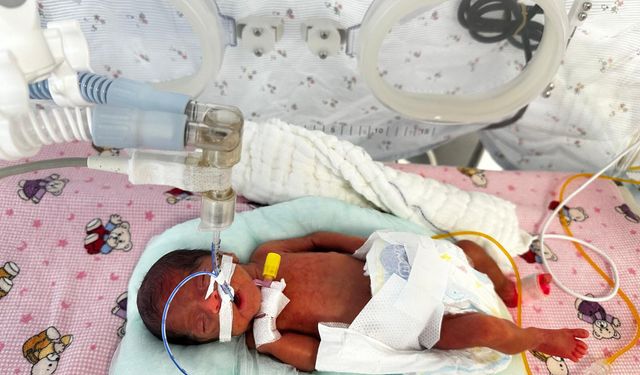 650 gram doğan 'Leyloş bebek' hayata tutundu