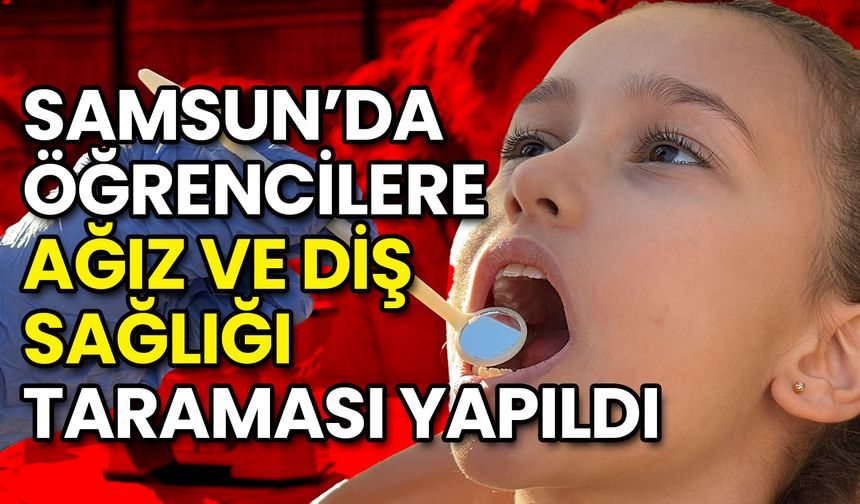 Samsun’da Öğrencilere Ağız ve Diş Sağlığı Taraması Yapıldı