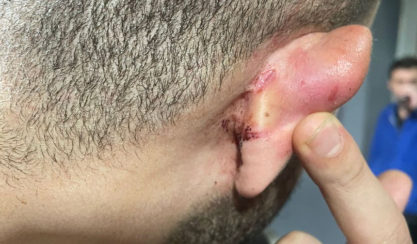 Artvin'de amatör maçta çıkan kavga kamerada