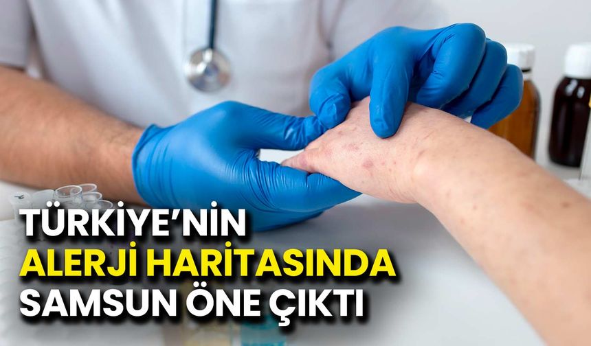 Türkiye’nin Alerji Haritasında Samsun Öne Çıktı
