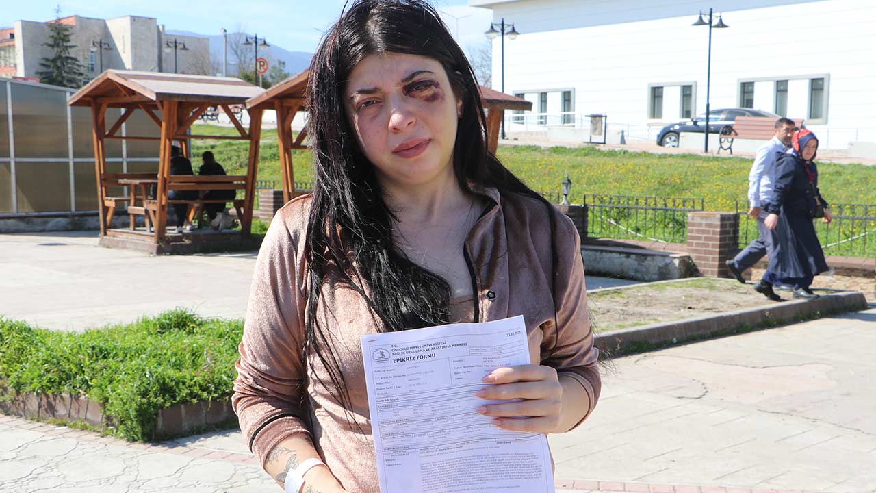 Samsun Sokak Ortasi Dayak 2