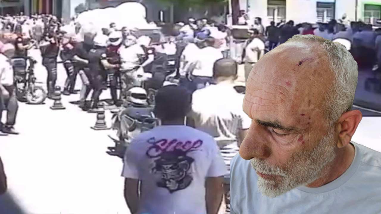 Samsun'da Gazeteciye Ters Kelepce 5