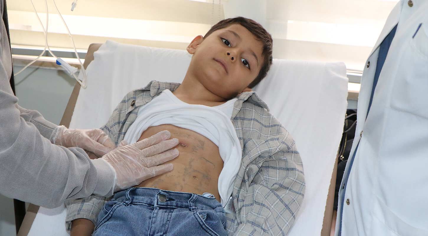 Diyafram Fitigi Samsun 2